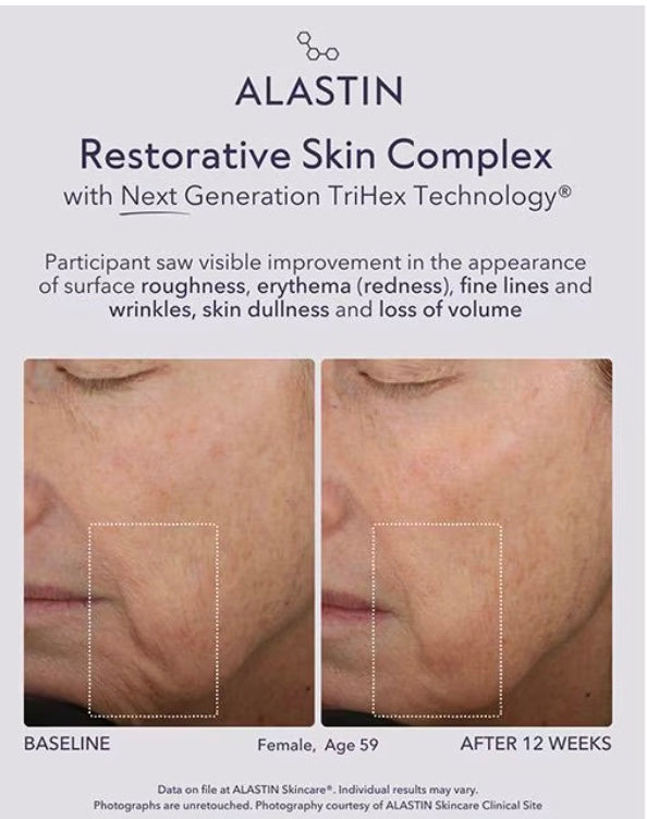 Alastin Restorative Skin Complex
