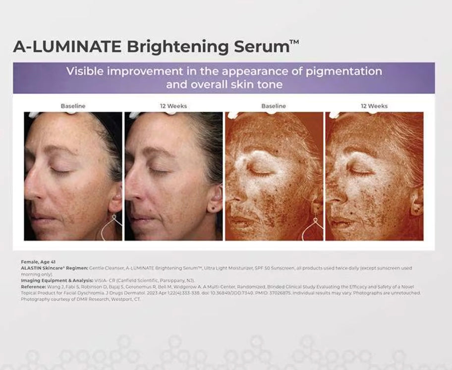 Alastin A-Luminate Brightening