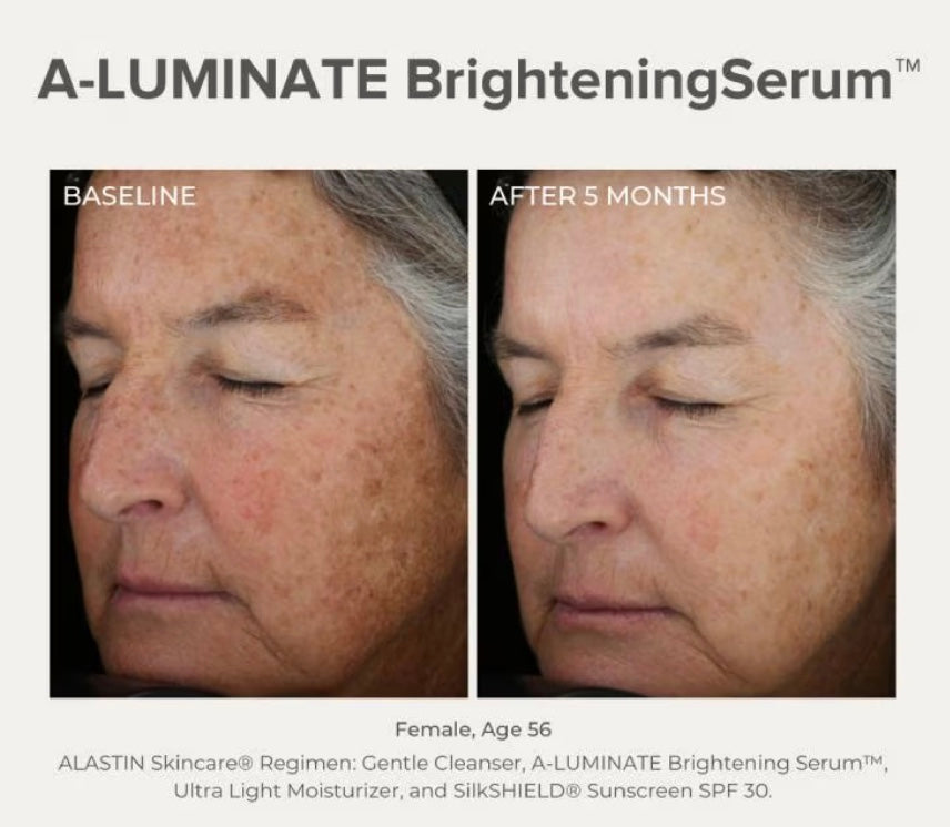 Alastin A-Luminate Brightening