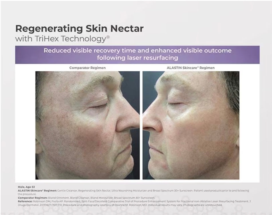 Alastin Skin Nectar 1oz